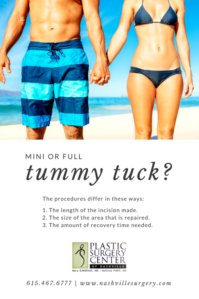 Mini or Full Tummy Tuck? We Can Help You Decide! | PSCON